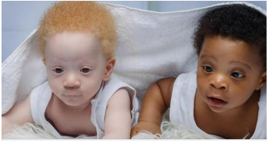 Mom Of Black And White Twins Boys Often Gets Asked Which One Is Hers