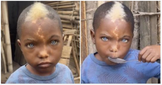 Little boy with natural blue eyes, white hair & lightning mark down his face goes viral