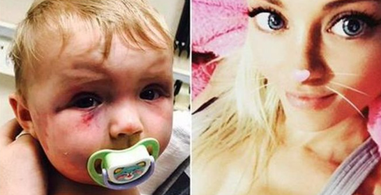 Mom beats baby black and blue with a spoon, judge’s punishment leaves the internet furious