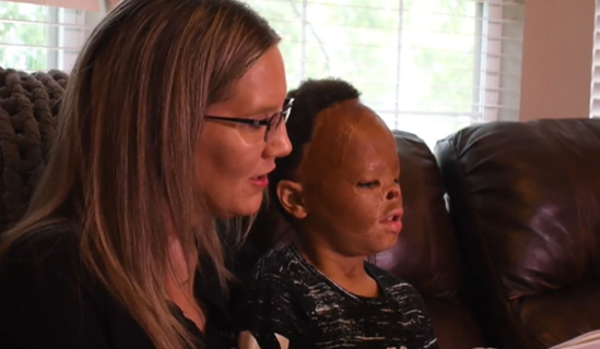 Foster baby is adopted 7 years after apartment fire left him with horrific burns