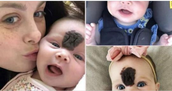 PARENTS KEPT THEIR BABY HIDDEN TO SHIELD HER FROM PEOPLE’S CURIOUS LOOKS. NOW, AT THE AGE OF 2, SHE LOOKS BEAUTIFUL